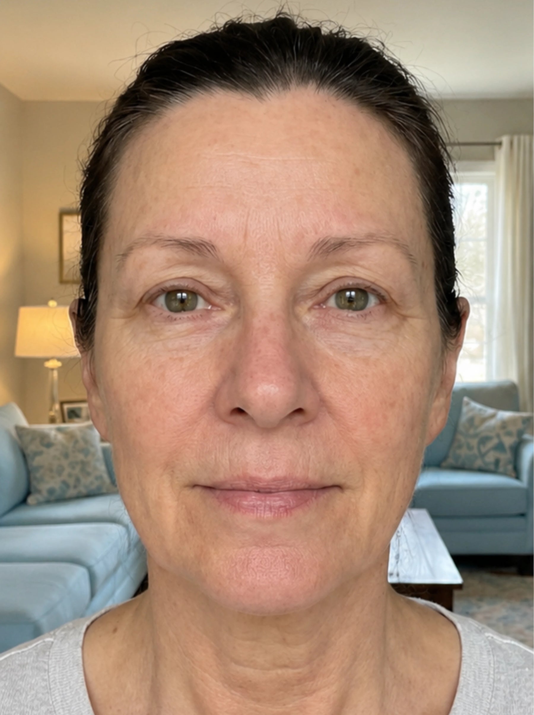 Before using the product